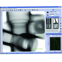 Software para Arquivamento Digital e Aprimoramento de Imagens de Raio X GE VISTAPLUS V