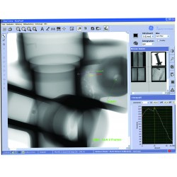 Software para Arquivamento Digital e Aprimoramento de Imagens de Raio X GE VISTAPLUS V