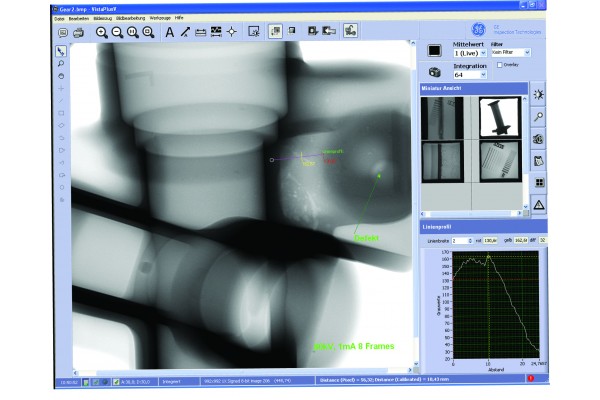 Software para Arquivamento Digital e Aprimoramento de Imagens de Raio X GE VISTAPLUS V